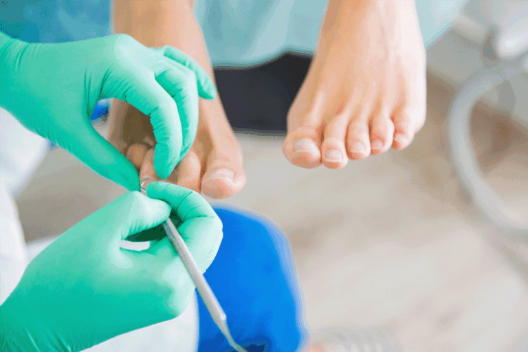 Pé Diabético: Cuidados Essenciais para Evitar Complicações